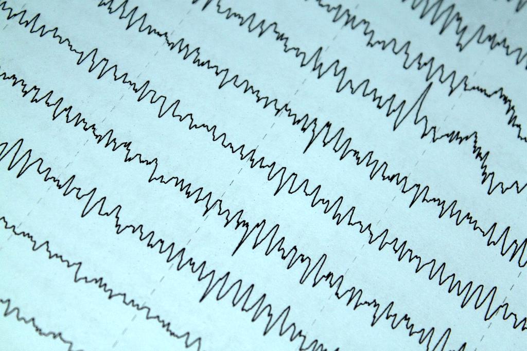 Wearable device tracking health metrics